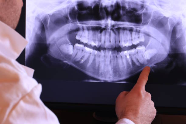 Best Emergency Dentist for Lost Fillings or Crowns in Westminster, CA
